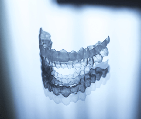 [＋α]安いインビザラインの落とし穴